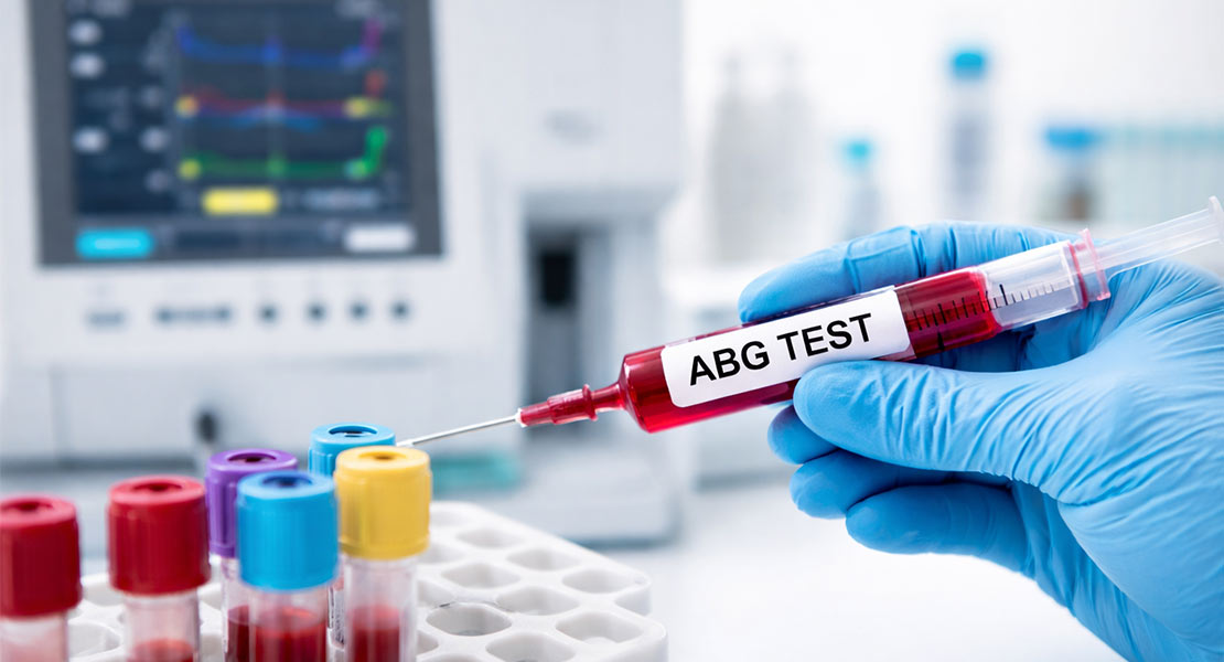 Doctor performing ABG test on woman patient