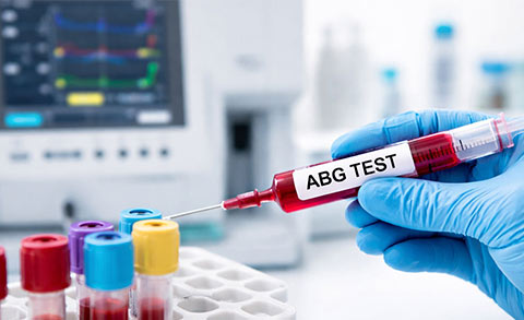 ECG at Home Safe Diagnostics