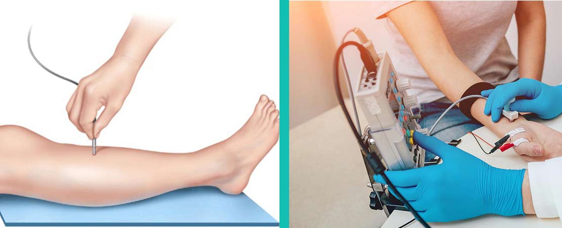 EMG Test in Delhi NCR, Gurgaon, Noida, Faridabad, Ghaziabad 