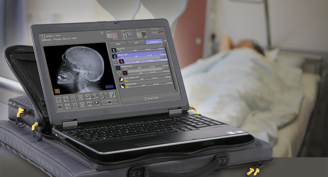 Home X-ray in Delhi Sukhdev Vihar