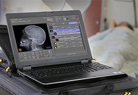 PORTABLE X-RAY at Hom Diagnostics